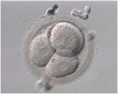 /album/fotogaleria-in-vitro/po%c5%82%c4%85czenie%20gamet-jpg/